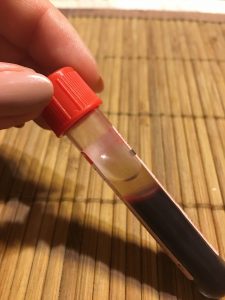 My Blood Test Results - PlantExclusiveLifestyle.com